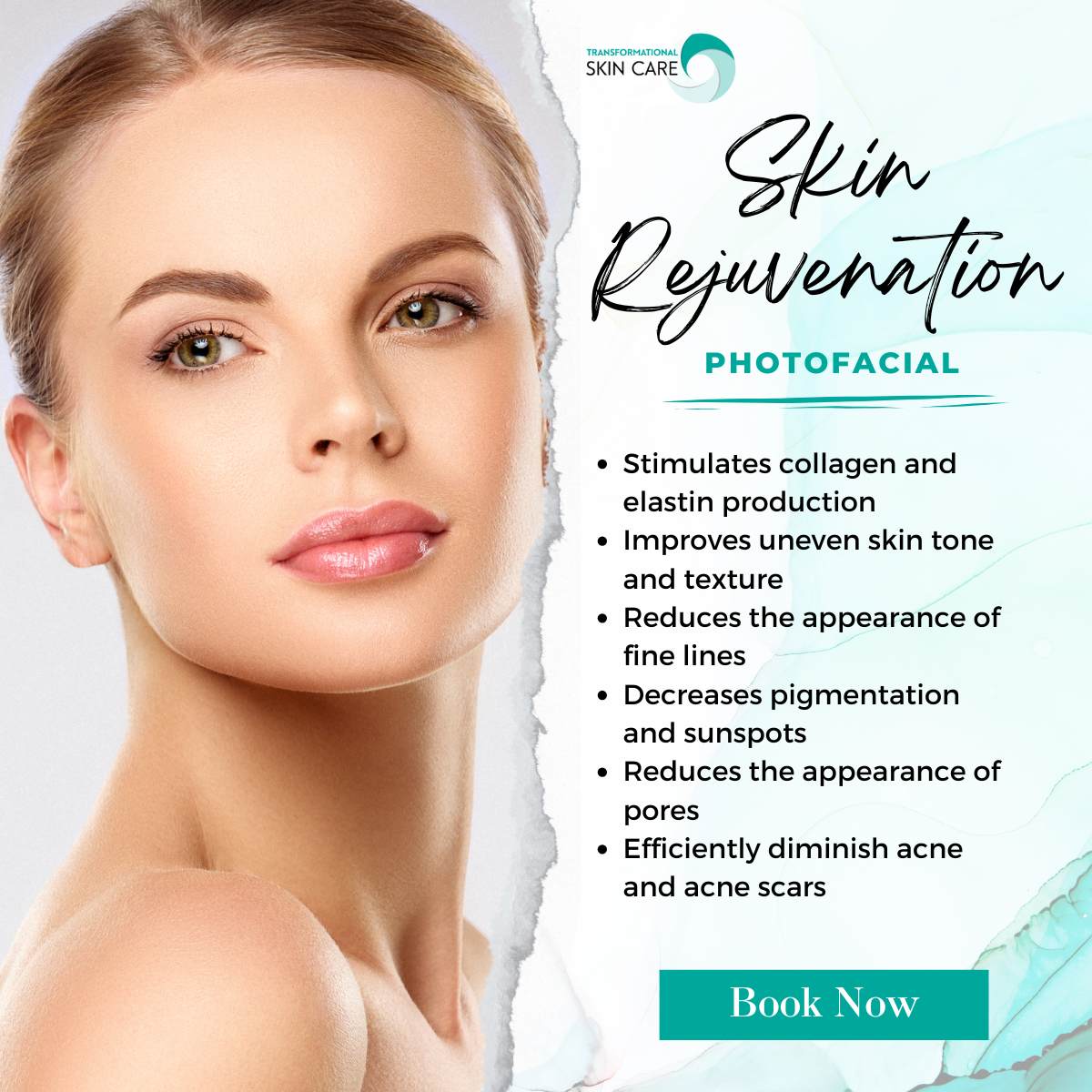Click this image to book your Skin Rejuvenation Facial