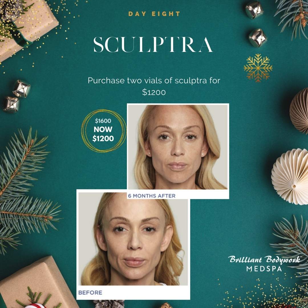 Day 8 of the Brilliant Bodywork 12 Days of Christmas Offers